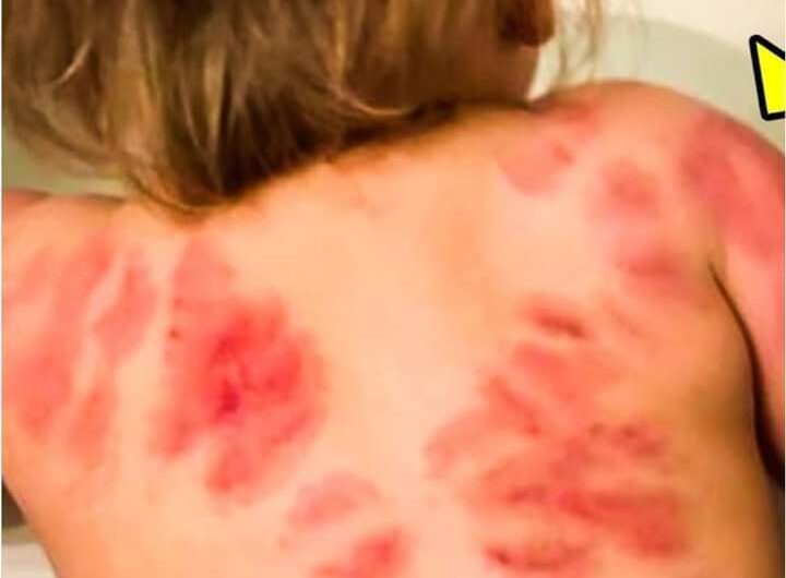 🚨😱Buscó A Su Hija De La Guardería Y Vio 25😱 Marcas De Mordeduras En Ella. ¡La Razón Es Horrible!. TOCA LAS LETRAS AZULES PARA VER LOS DETALLES👉👇👇👇👇👇