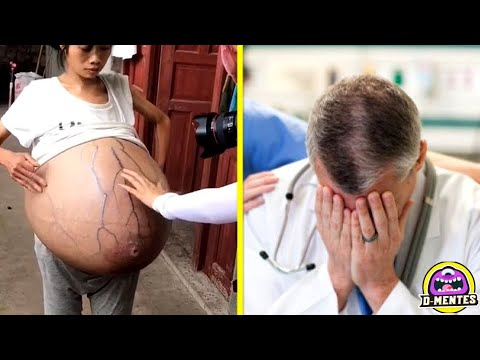 ⛔️Sorprendente 😨 Lo que había en su vientre nunca habían sido visto en la historia.Los medicos quedaron horrorizados❗️❗️😱.Toca las letras azules para verlo 👇🏻👇🏻👇🏻👇🏻👇🏻