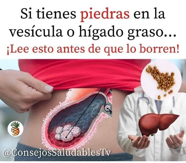 🚨Como limpiar el hígado con remedios caseros y también la vesícula biliar naturalmente.👍 Vea toda la Información AQUÍ👇👇
