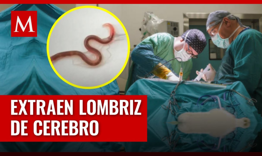 😱🚨Un grupo de neurocirujanos extrajeron del cerebro de una mujer australiana una #lombriz intestinal viva de 8 centímetros, el primer caso de este tipo en humanos 😱 VEA MÁS DETALLES AQUÍ TOCANDO EN LAS LETRAS AZULES👇👇