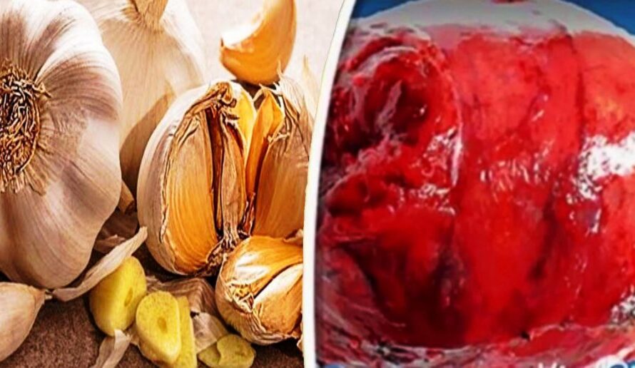 😱El ajo mata 14 tipos de cáncer y 13 tipos de infección ¿Mito o realidad?. Mira toda la información aquí…👇🏻👇🏻👇🏻
